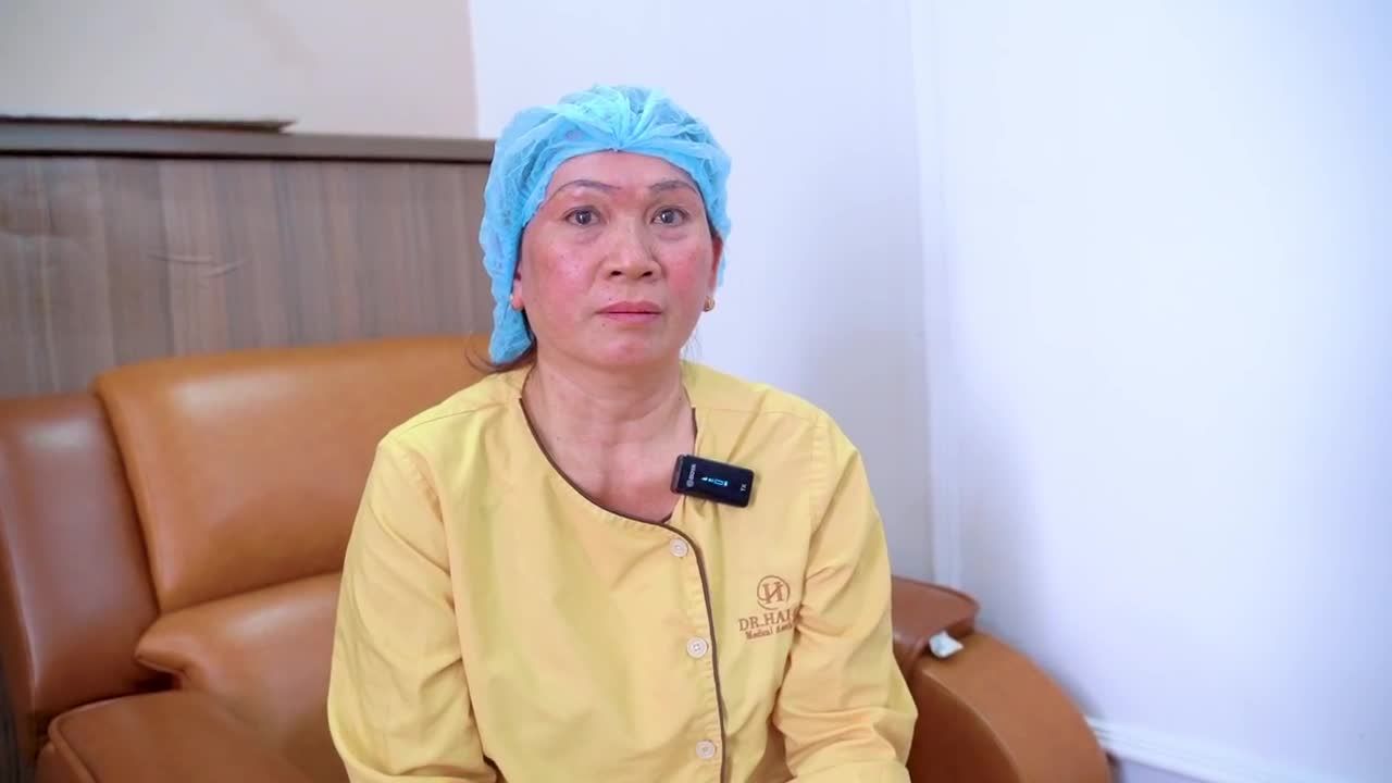 Nâng cung mày xong tại Dr.Hải Lê cơ sở HCM tôi thấy trẻ và nhẹ mắt lắm rồi nè